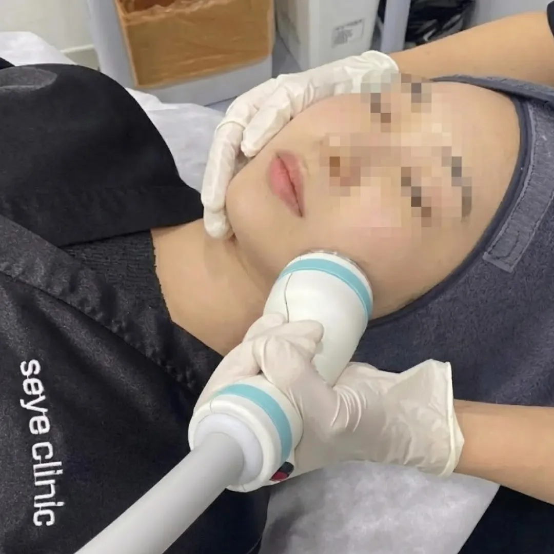 온다리프팅 효과 통증.webp