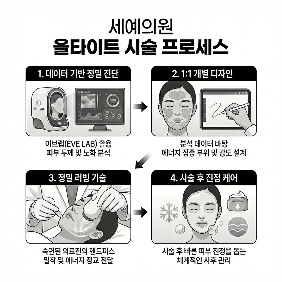 올타이트 시술 방식.webp