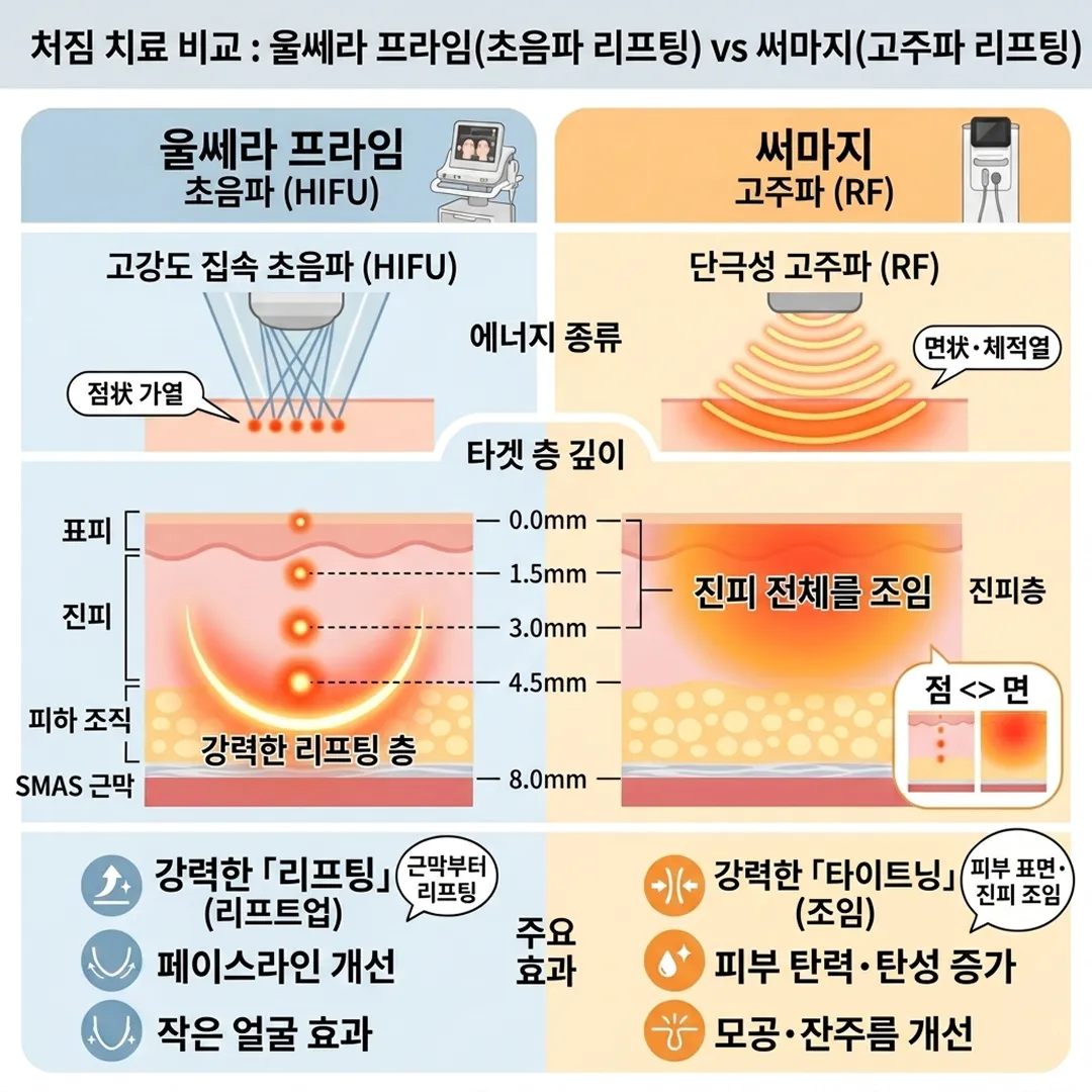 울쎄라, 써마지 비교-1.webp