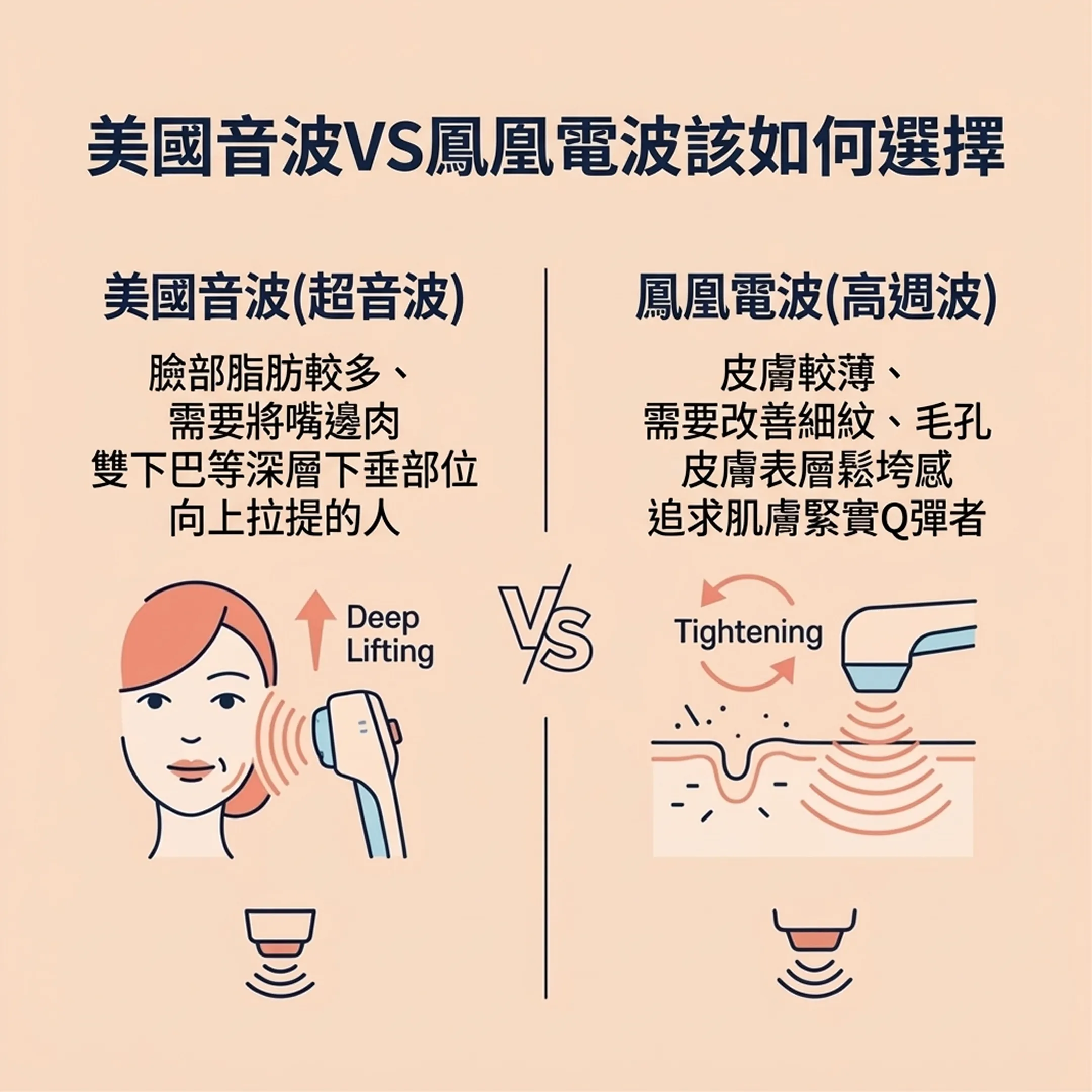 울쎄라-써마지-선택-美國音波-超音波-鳳凰電波-高週波-美國音波VS鳳凰電波該如何選擇-雙下巴等深層下垂部位-zh-tw.webp