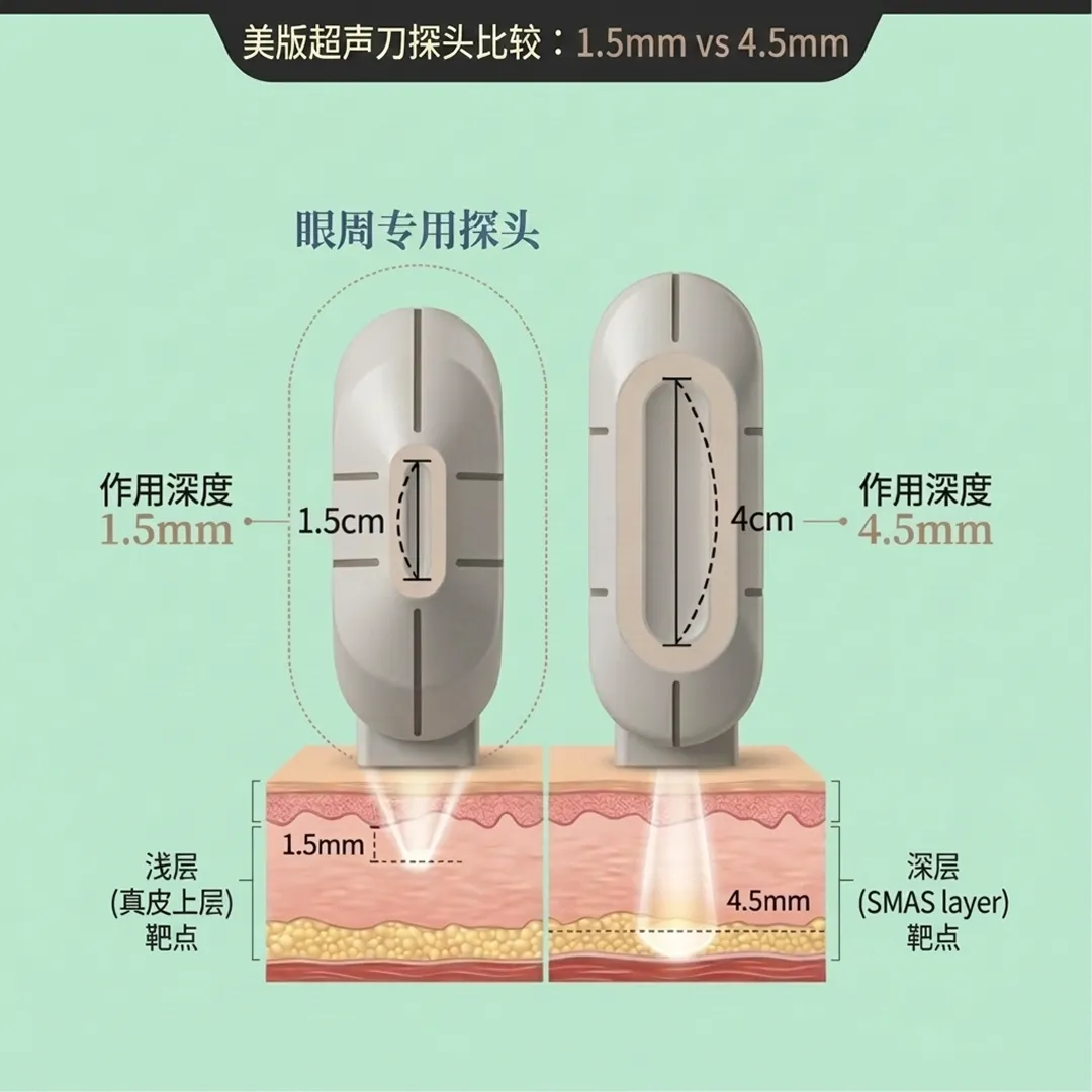 울쎄라-팁-比較-Ulthera美版超声刀探頭比較:1-5mm-美版超声刀探头比较:1-vs-4-1-5cm-zh-cn.webp