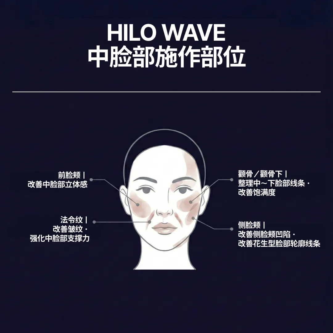 인중축소술-부작용_CN간체.webp