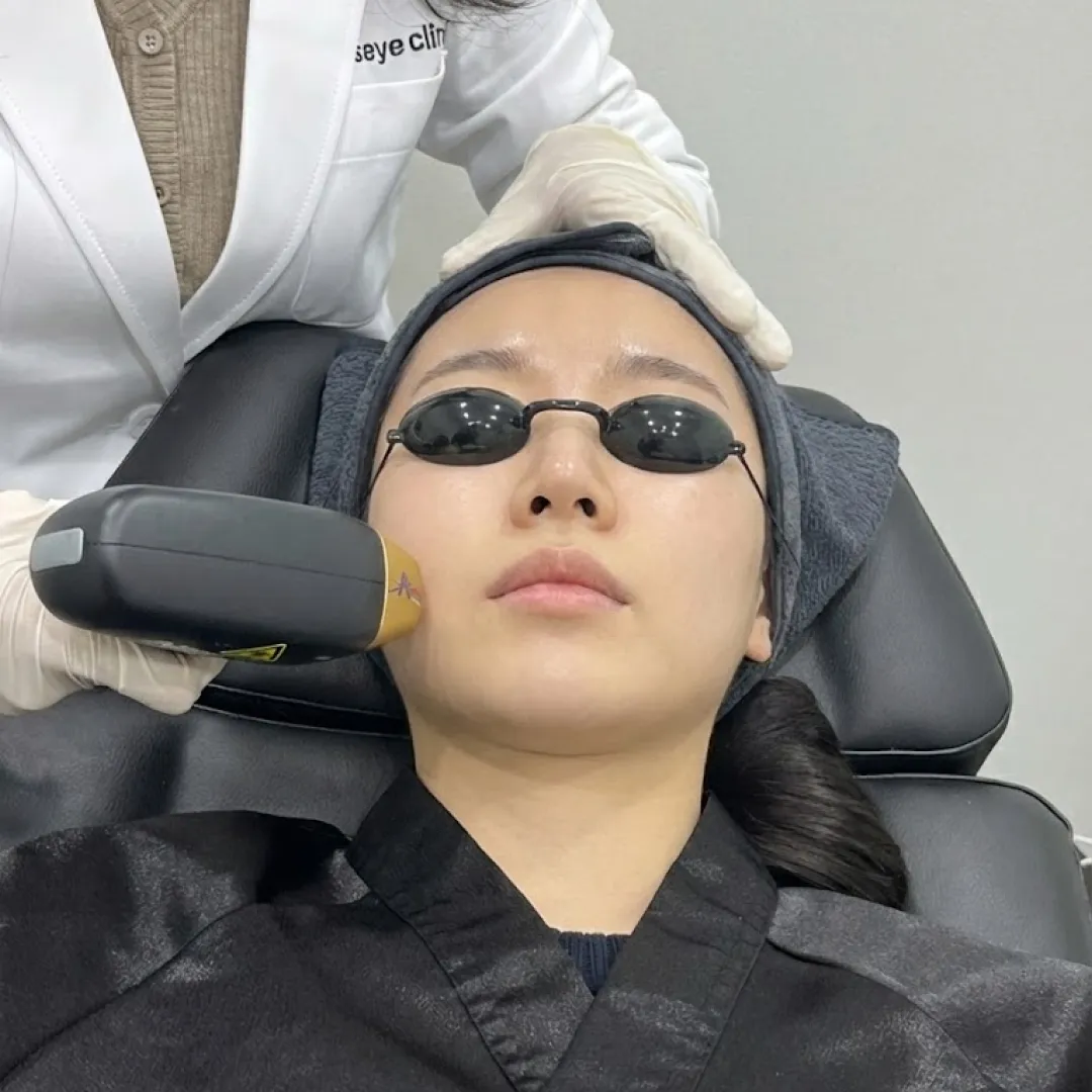 티타늄리프팅 후기 병원.webp