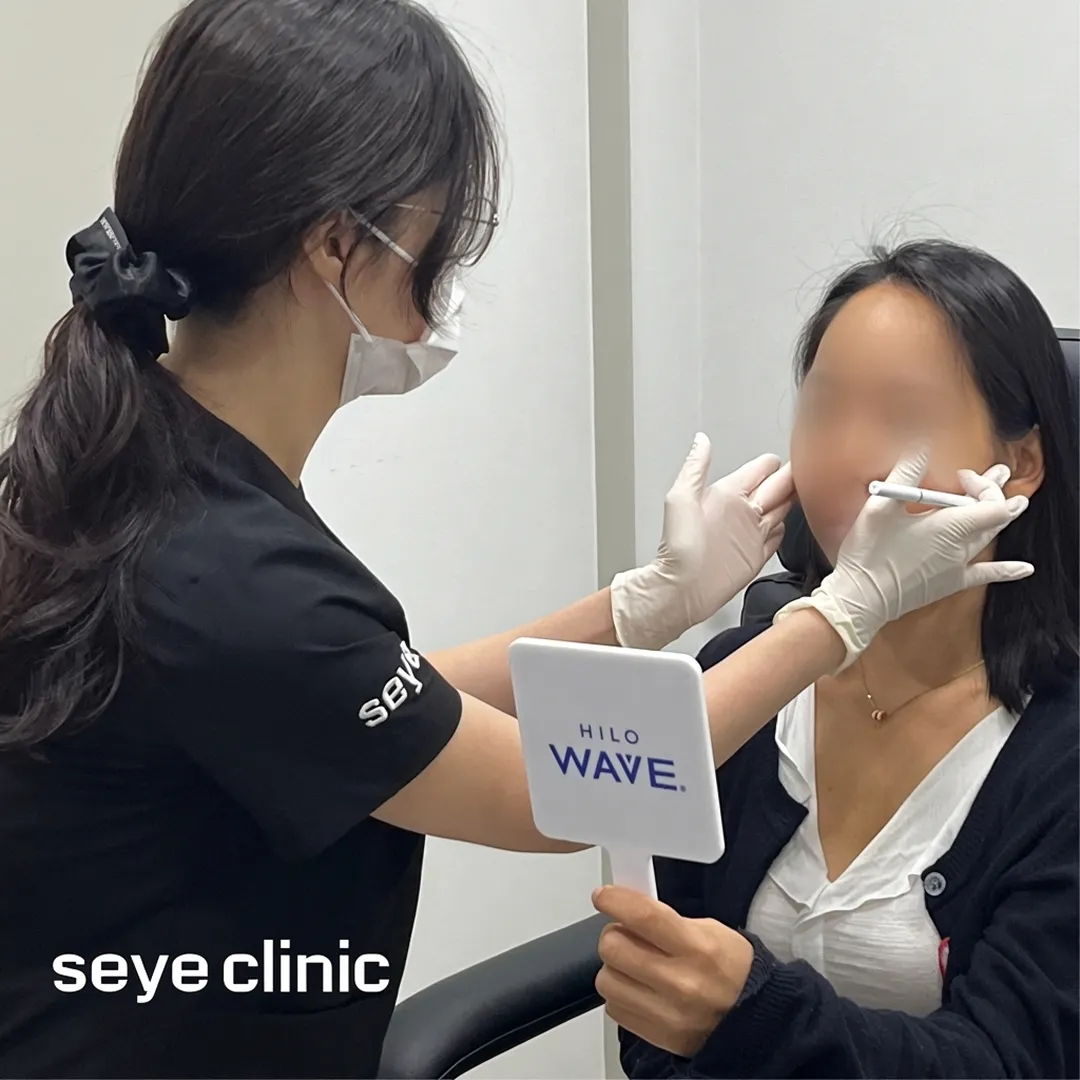 힐로웨이브-評價-seye-clinic-HILO-WAVE-zh-tw.webp