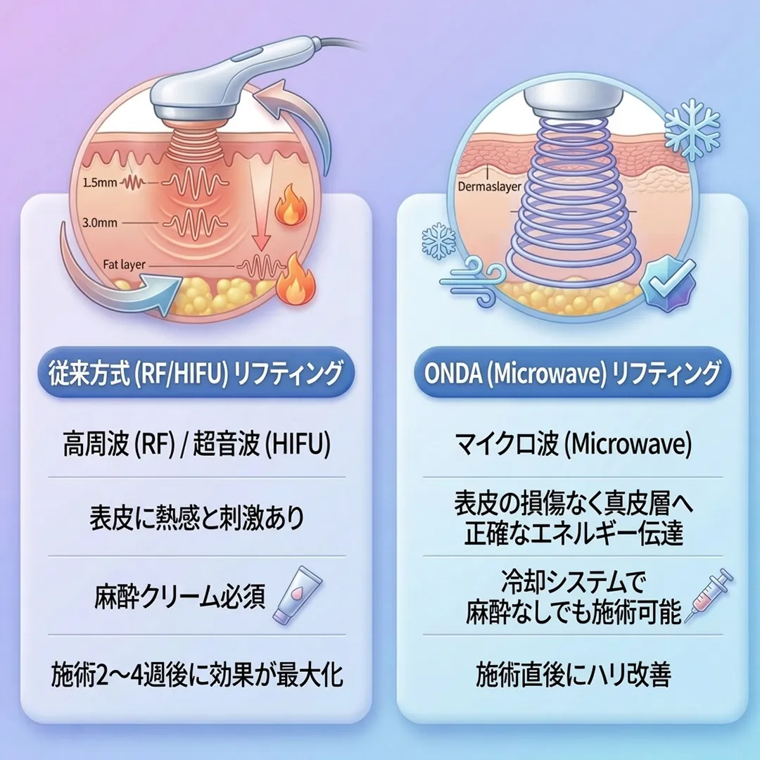 従来方式とオンダリフティングの違い