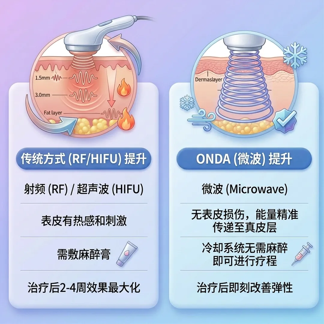 1传统方式-RF-HIFU-提升-射频-超声波-ONDA-微波-Microwave-zh-cn.webp