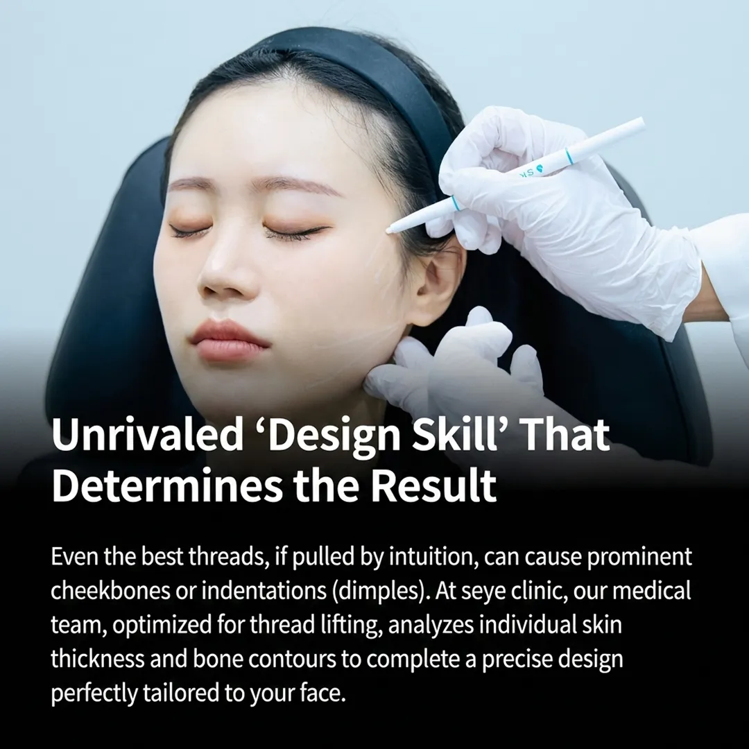 Seye Clinic's unrivaled design skill prevents prominent cheekbones and dimples during thread lifting