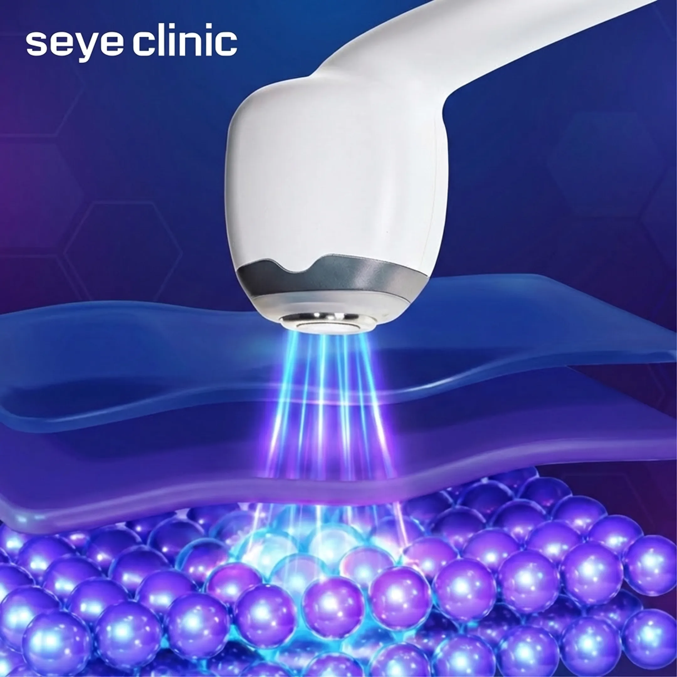 Alltite拉提-Alltite-原理-seye-clinic-zh-tw-1.webp
