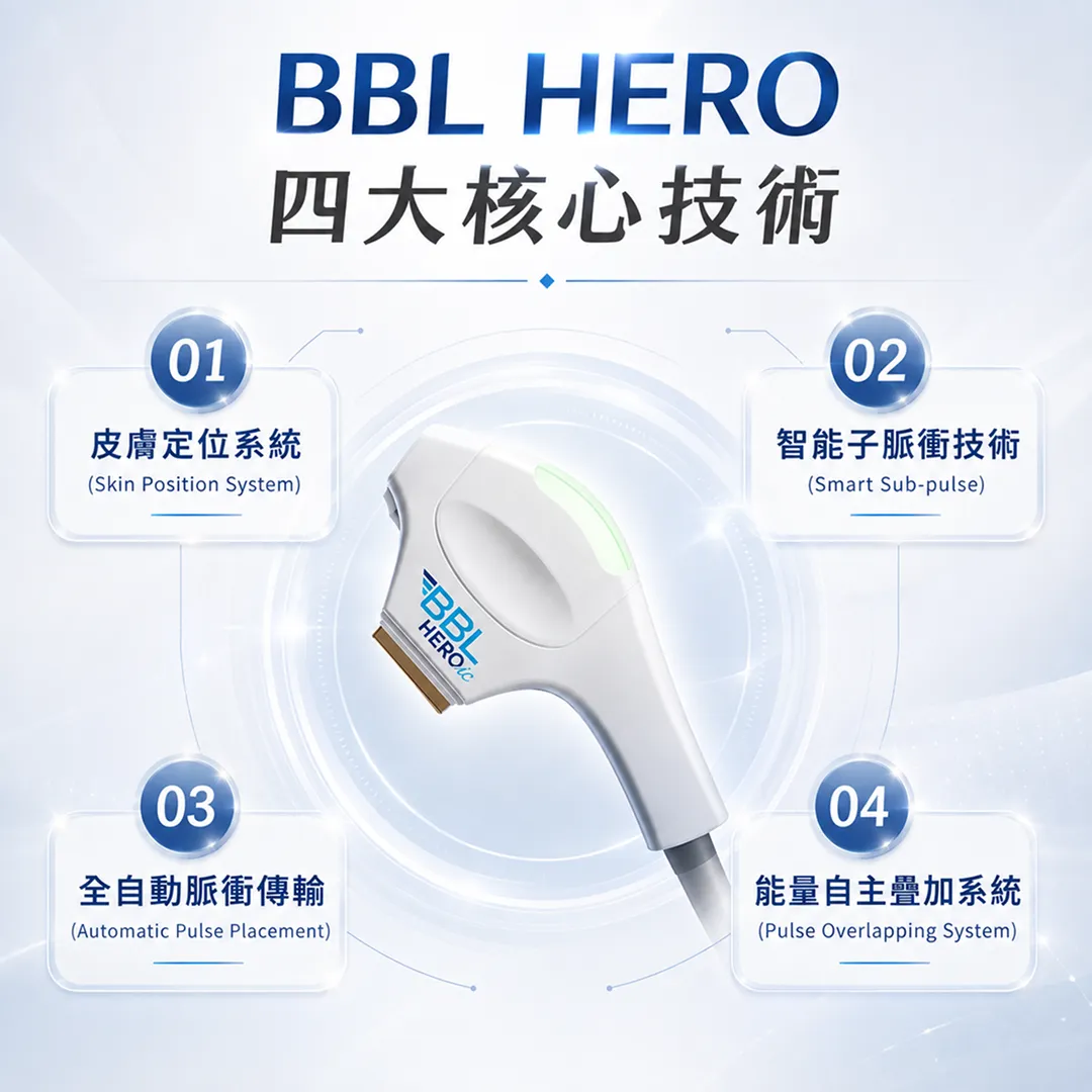 BBLHEROic四大核心技術皮膚定位智能子脈衝自動傳輸能量疊加說明圖-bbl-hero-four-core-technologies-skin-position-smart-subpulse-guide-seyeclinic.webp