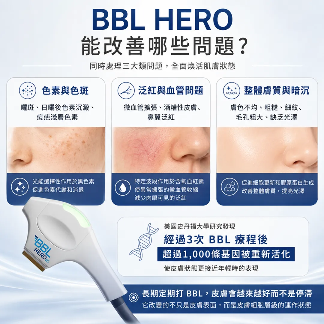 BBLHEROic能改善色斑泛紅暗沉膚質老化問題說明圖-bbl-hero-skin-concerns-pigmentation-redness-dullness-aging-seyeclinic.webp