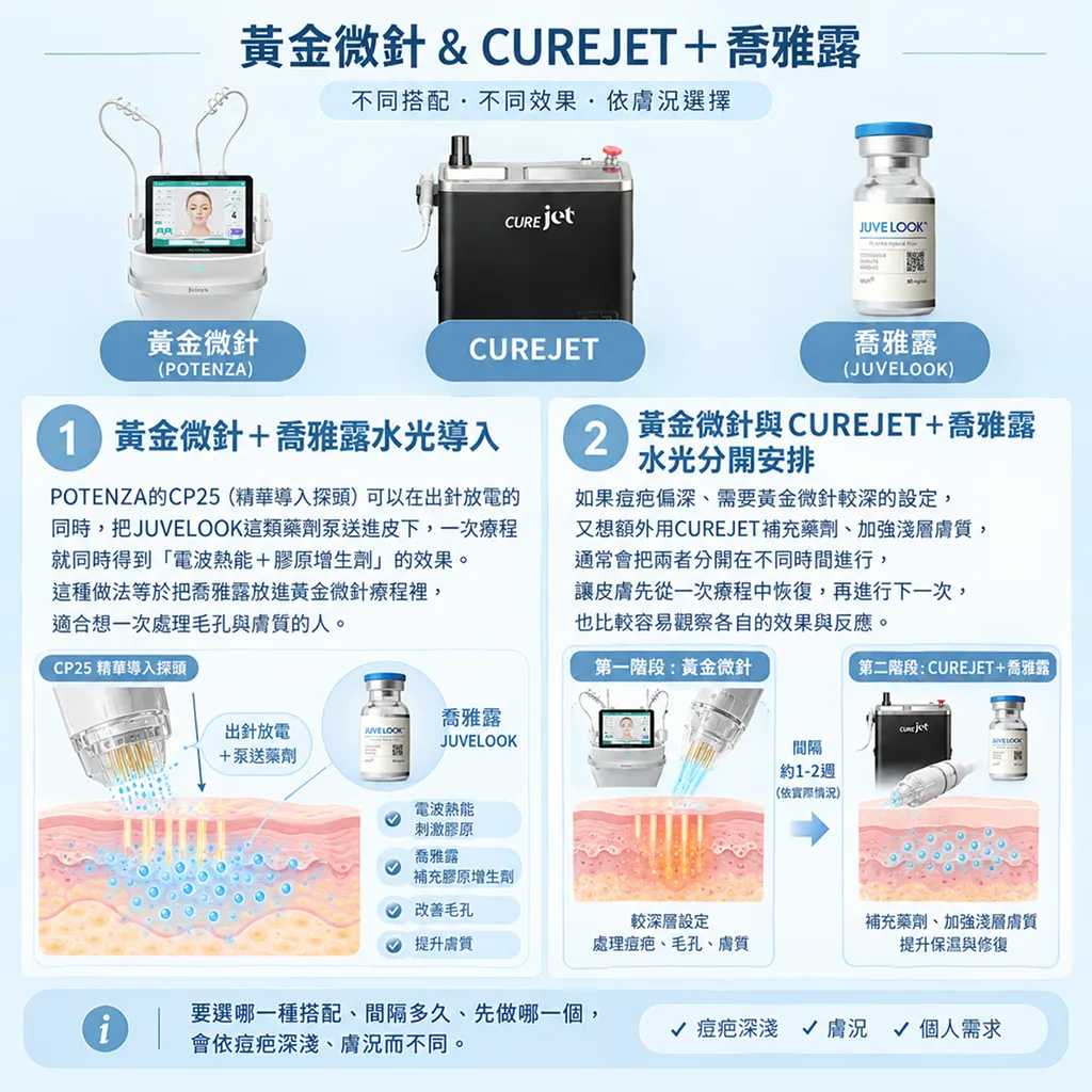 CUREJET喬雅露與黃金微針搭配安排示意-curejet-juvelook-potenza-combination-seyeclinic.webp 1.png