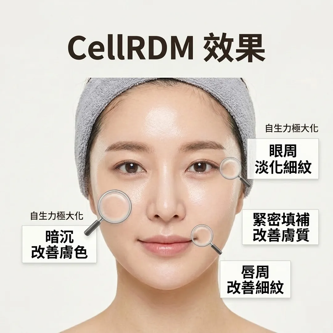 CellRDM-效果-自生力極大化-淡化細紋-zh-tw-1.webp