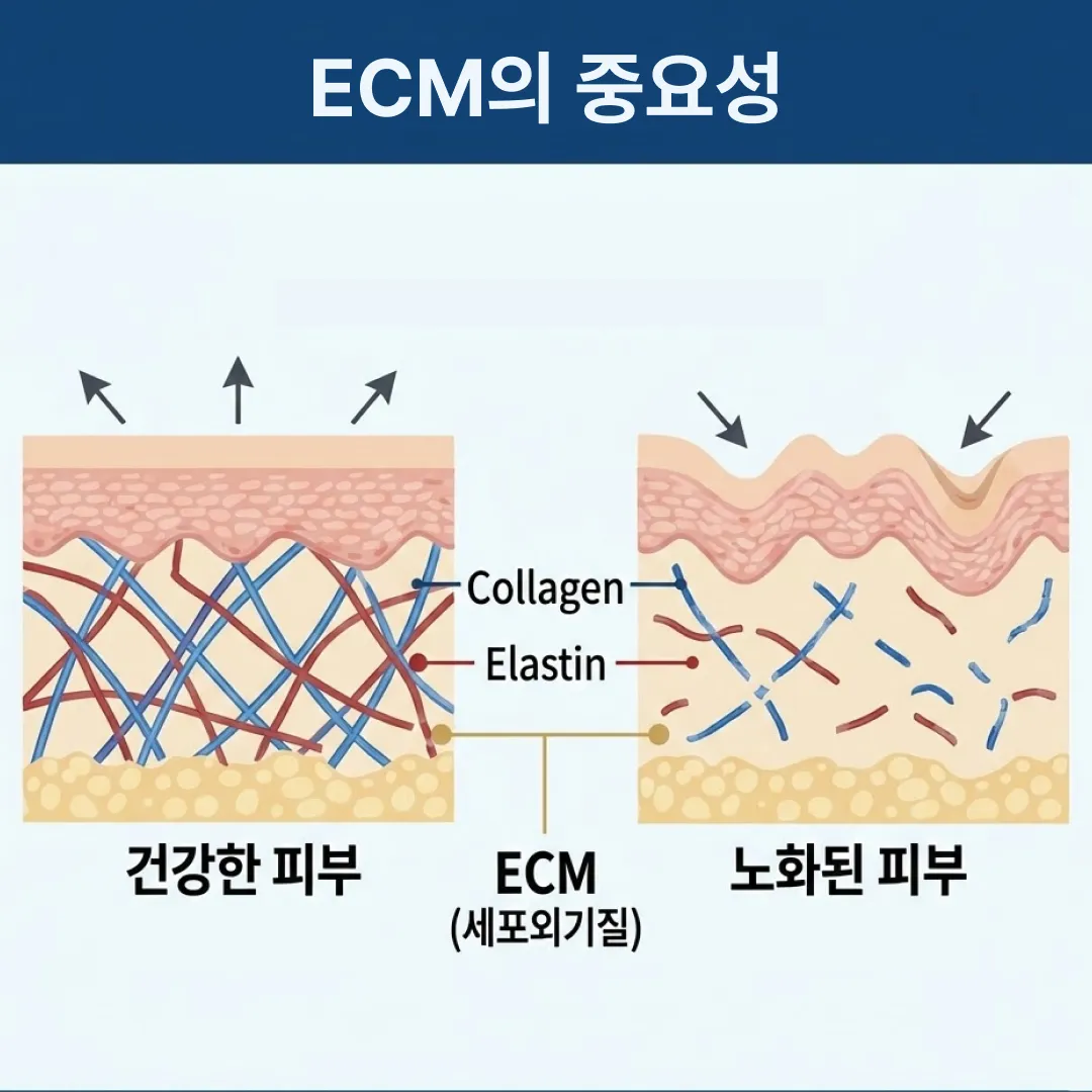 ECM 스킨부스터 역할.webp
