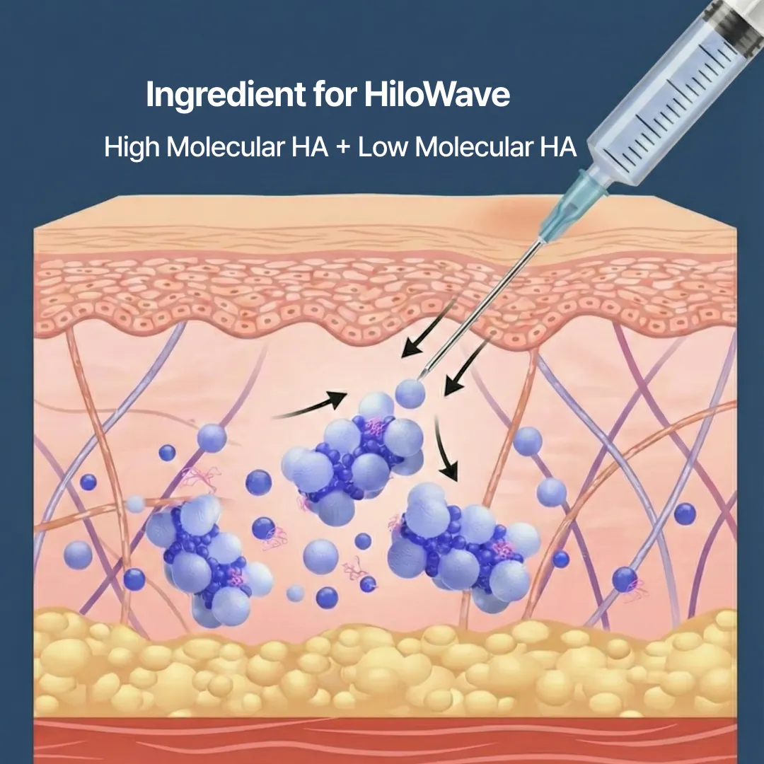 Seye Clinic medical team providing 1:1 consultation for HiloWave procedure.