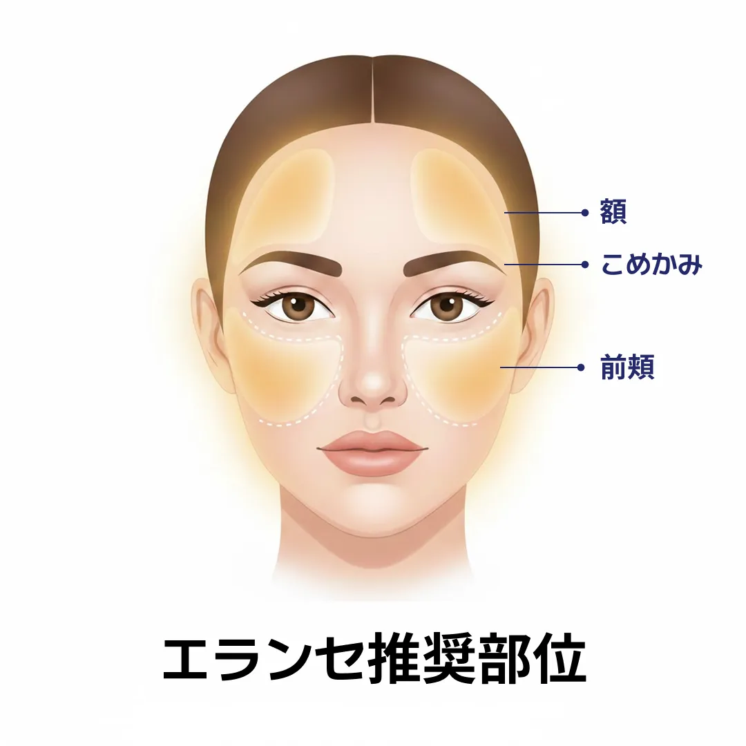 JP_엘란쎄 필러 부위.webp