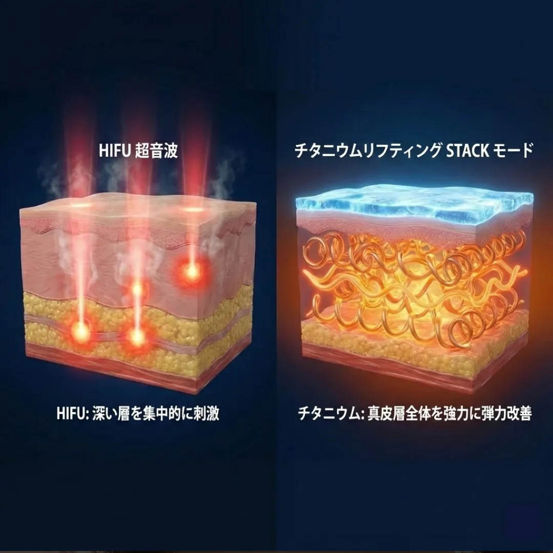 チタニウムリフティングの効果は1ヶ月で消える?維持期間を延ばす秘訣