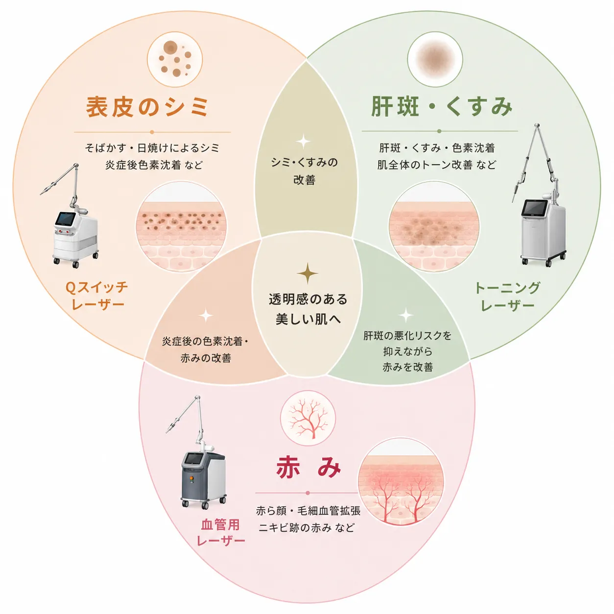 Mjoule BBL、ピコトーニング、エクセルVがそれぞれどの肌悩みに適しているかを示したベン図.webp