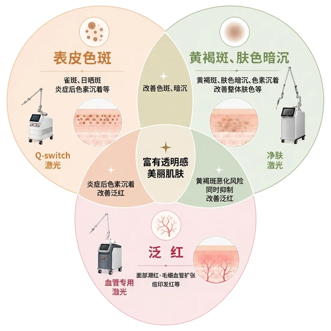 Mjoule-BBL黄褐斑、肤色暗沉、色素沉着-黄褐斑、肤色暗沉-zh-cn.webp