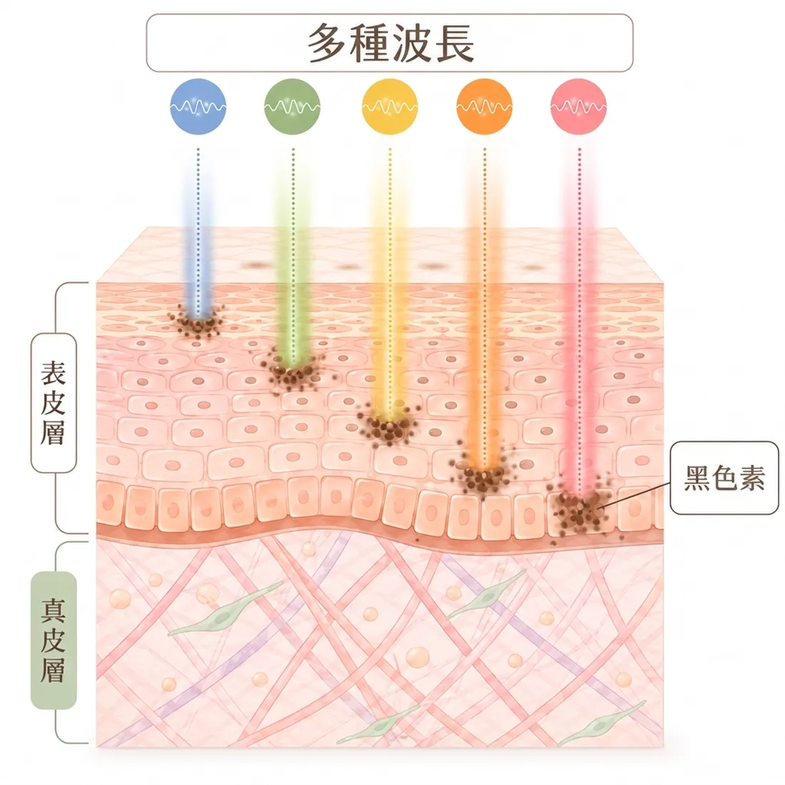 Mjoule-BBL-多種波長-黑色素-zh-tw.webp