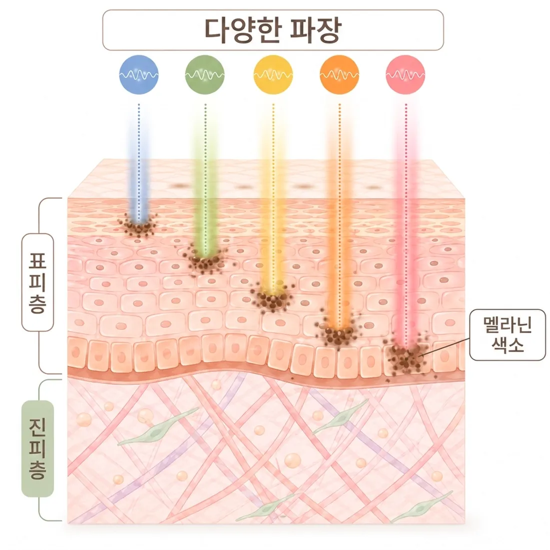 Mjoule-BBL-파장.webp