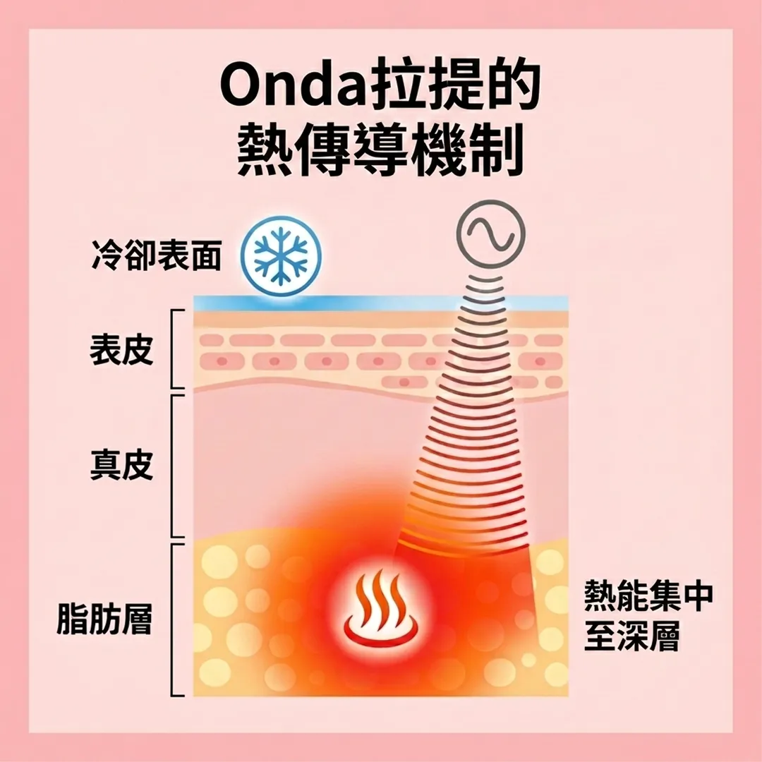 Onda拉提的熱傳導機制