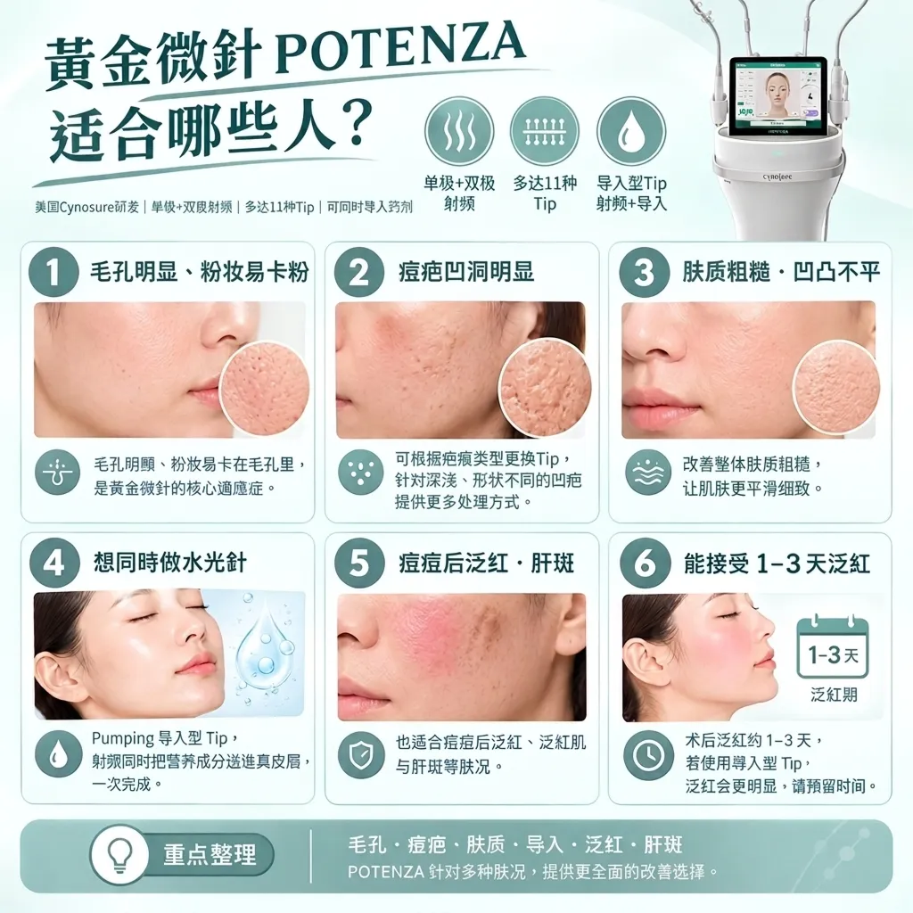 Virtue RF适用人群:兼顾紧致、毛孔、肤质,怕痛,恢复期短,皮肤偏薄或不同部位需求定制