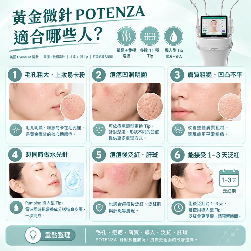 POTENZA適合族群對照-potenza-suitable-candidates-seyeclinic.webp.webp