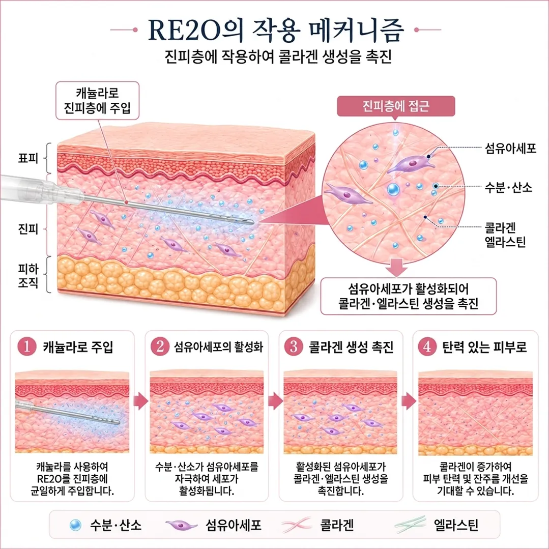 RE2O원리.webp