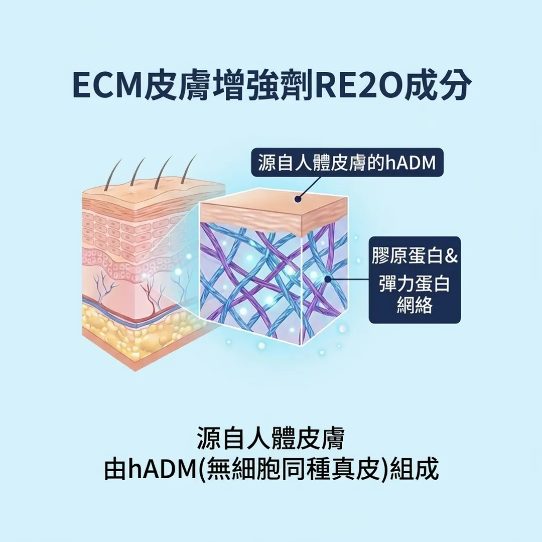 RE2O-由hADM-無細胞同種真皮-組成-ECM皮膚增強劑RE2O成分-源自人體皮膚的hADM-源自人體皮膚-zh-tw.webp