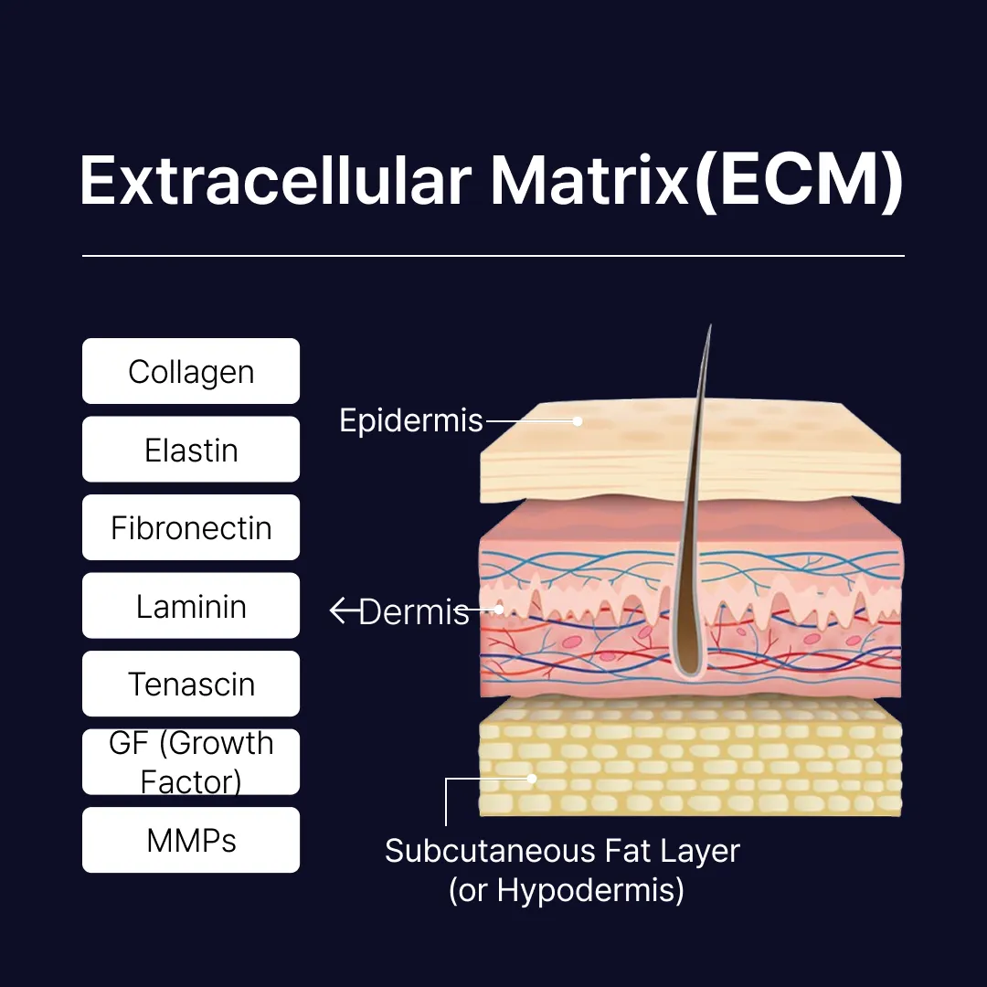 RE2O hADM injection diagram showing ECM reconstruction for under-eye wrinkles and hollowness