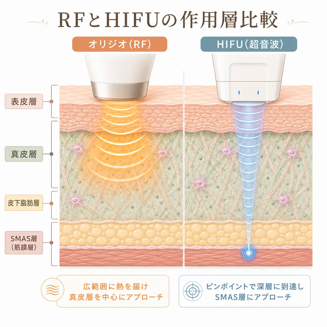 RFとHIFUの作用層比較.webp