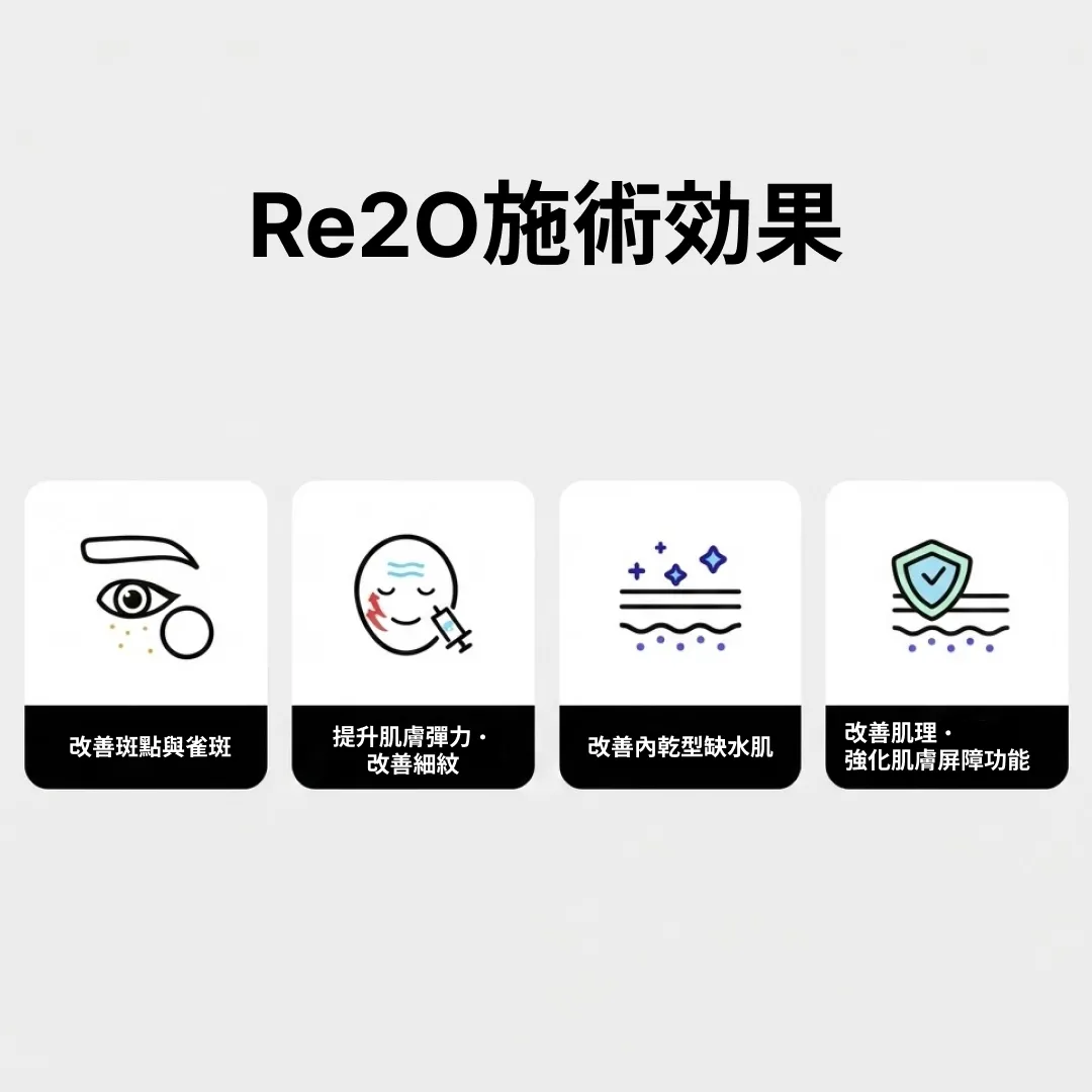 Re2O施術効果.webp