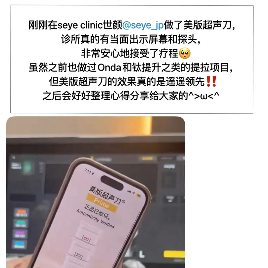 SEYE正品探頭後記2-ultherapy-authentic-probe-check-刚刚在seye-clinic世颜-seye-jp做了美版超声刀-刚才去seye-clinic-zh-cn.webp
