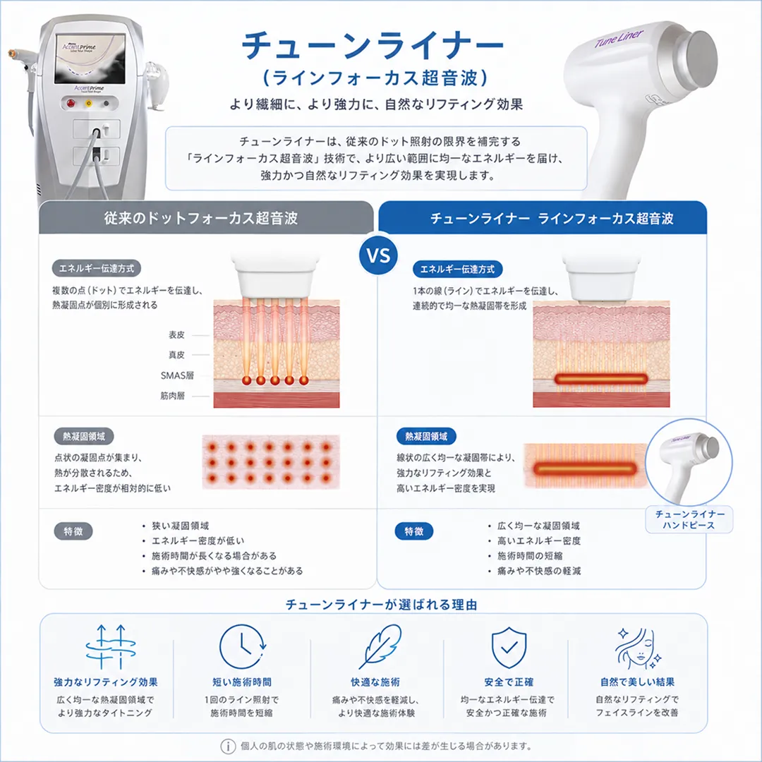 Tune-Liner-line-focus-ultrasound-with-traditional-dot-focus-ultrasound.webp