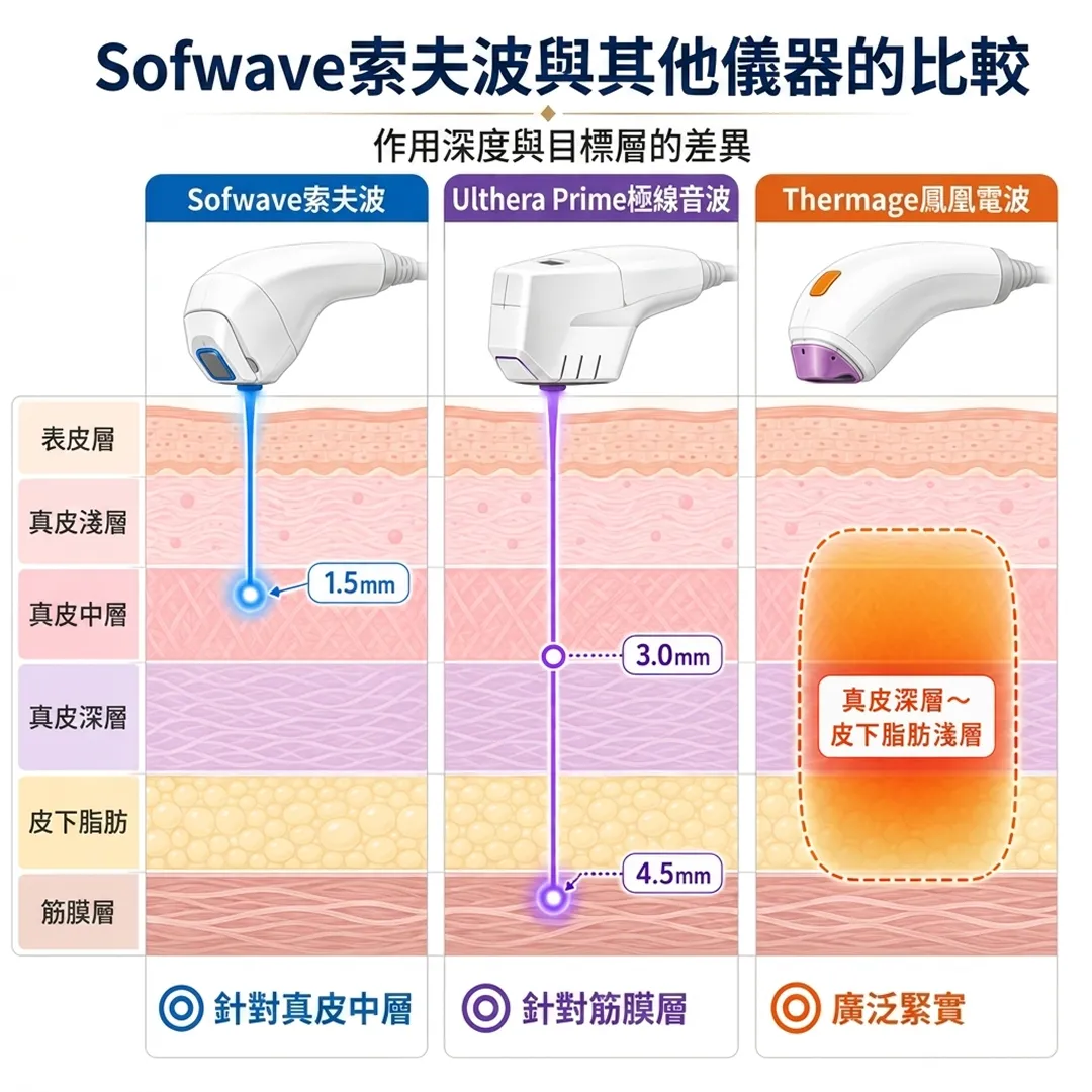 Ulthera-Prime-美國音波-極線音波-Sofwave索夫波與其他儀器的比較-1-5mm-Thermage鳳凰電波-zh-tw.webp