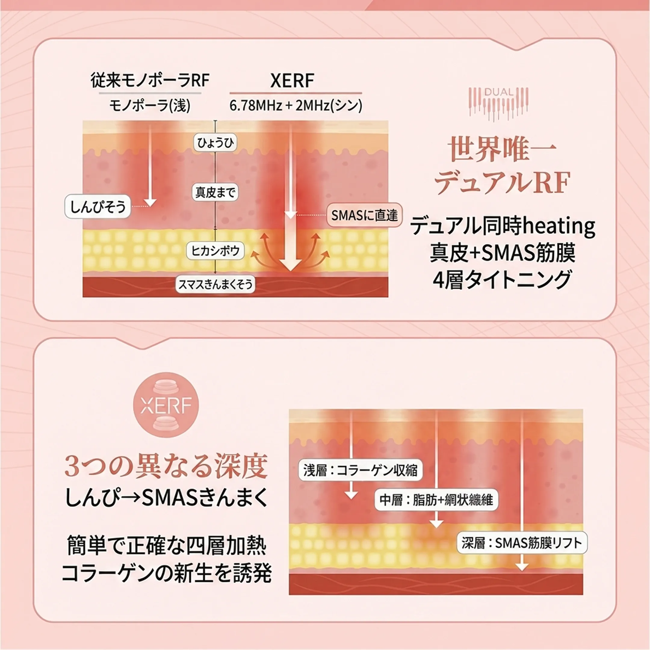 XERFで改善が期待できる顔のたるみ部位.webp