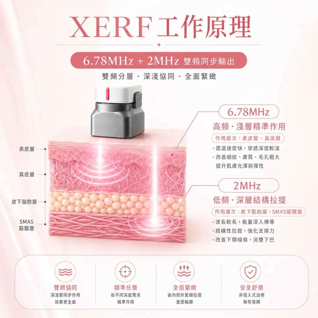 XERF-Wave-Fit-Pulse™蜘蛛網探頭技術原理-工作原理-雙頻同步輸出.webp