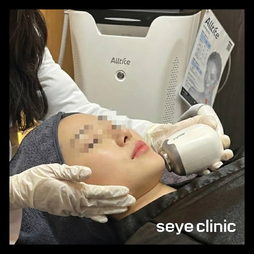 alltite_seyeclinic.webp