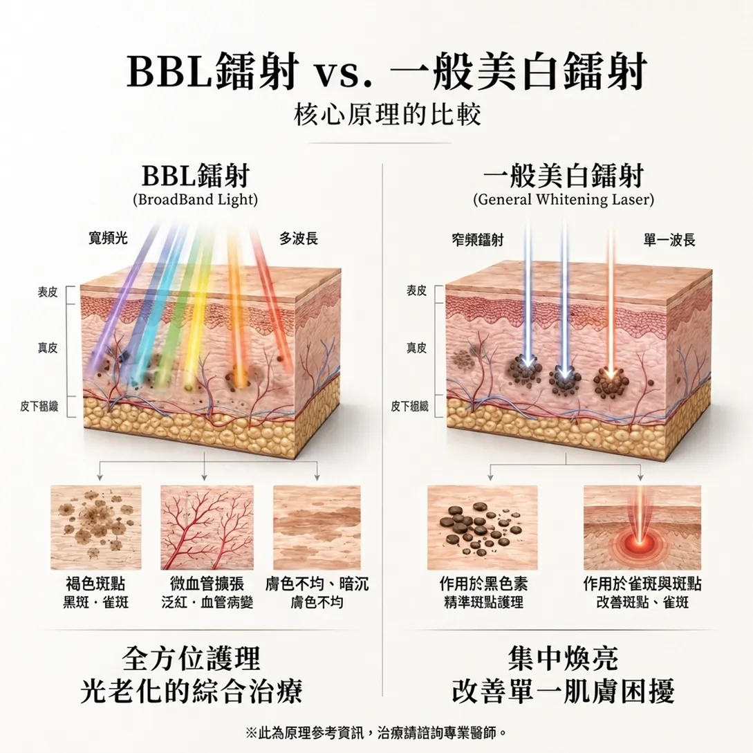bbl-hero-BBL雷射-一般美白雷射-多波长-美白抗老-色素斑点——.webp