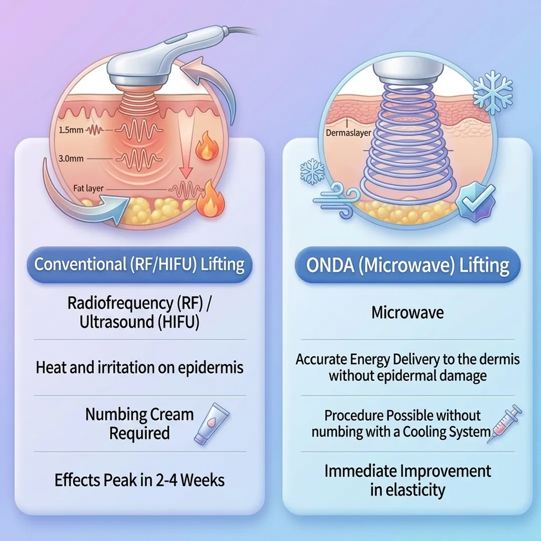 Comparison of Conventional RF/HIFU Lifting vs Onda Microwave Lifting