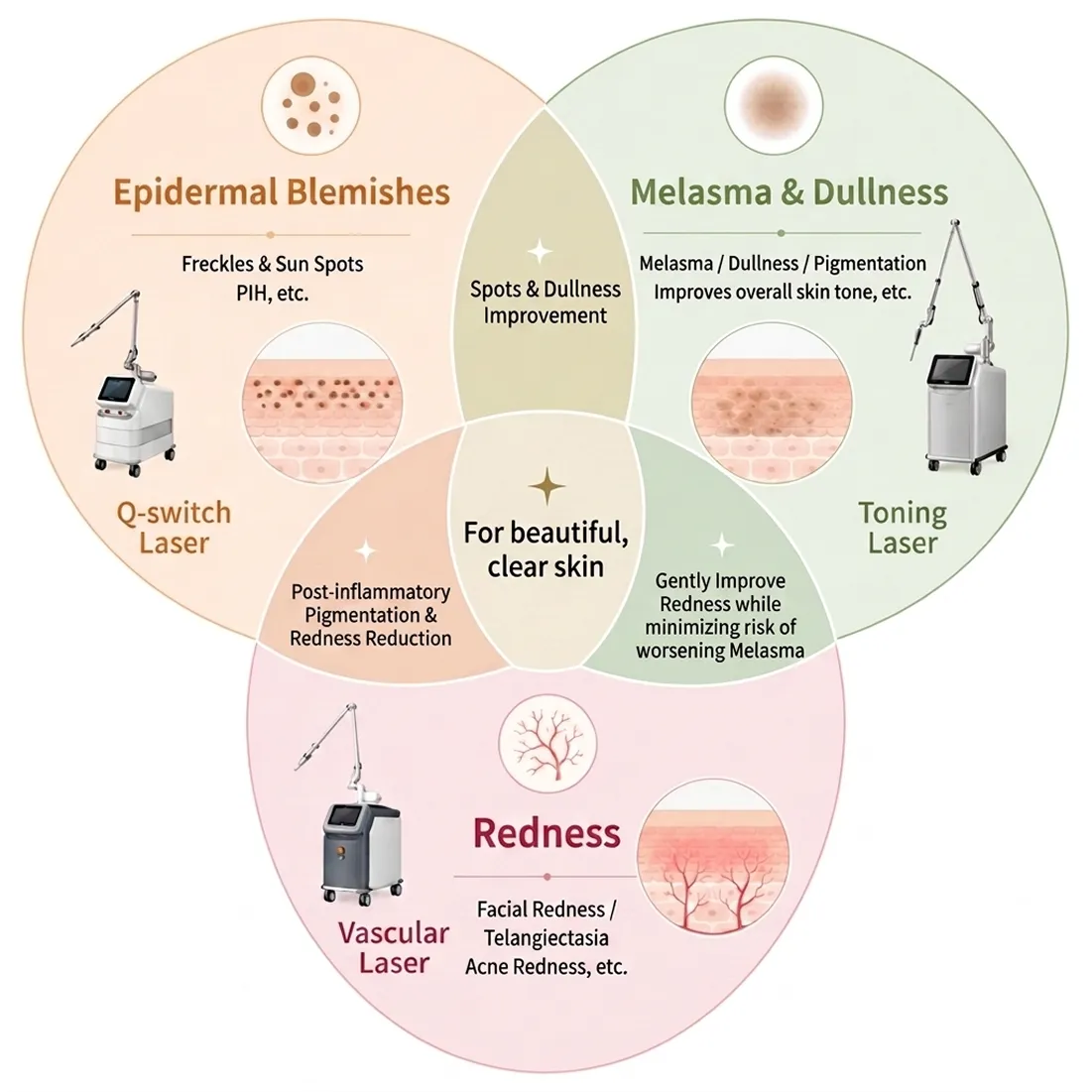 mjoule-bbl-1-improves-overall-skin-freckles-sun-spots-epidermal-blemis-melasma-en.webp