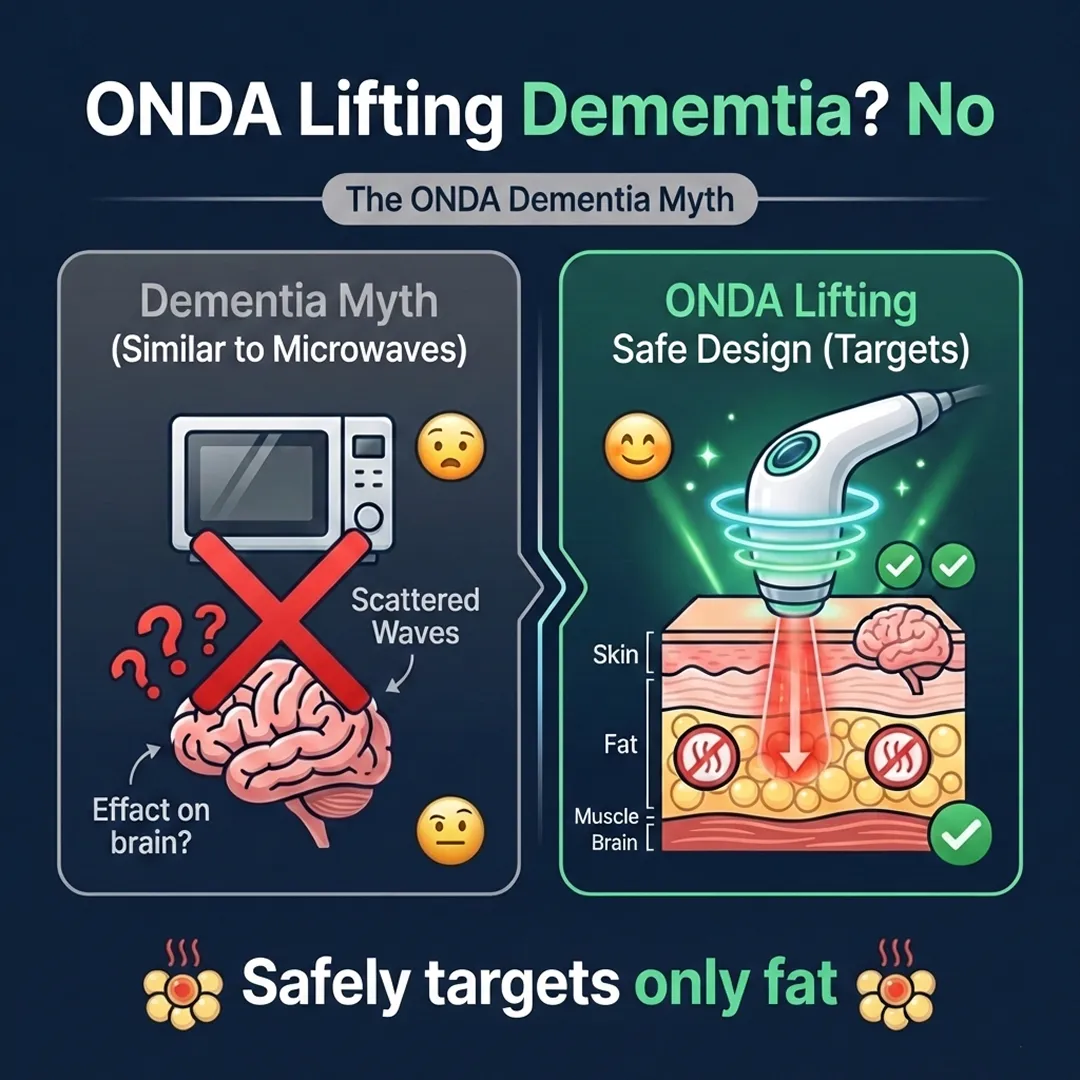 A comparison table of Onda Lifting versus Ultherapy, highlighting differences in energy, targets, and pain levels.