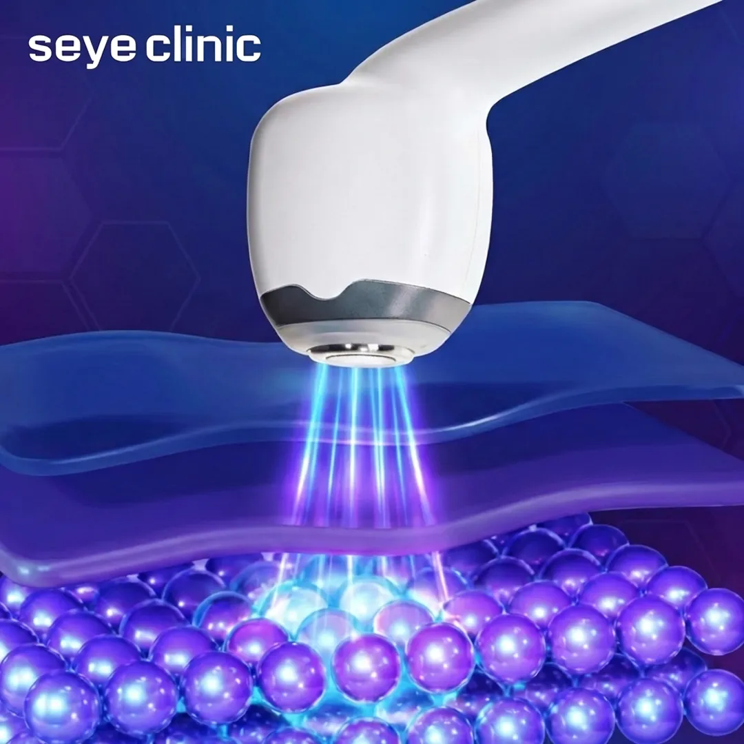DLTD mechanism of Alltite targeting dermis for painless skin tightening