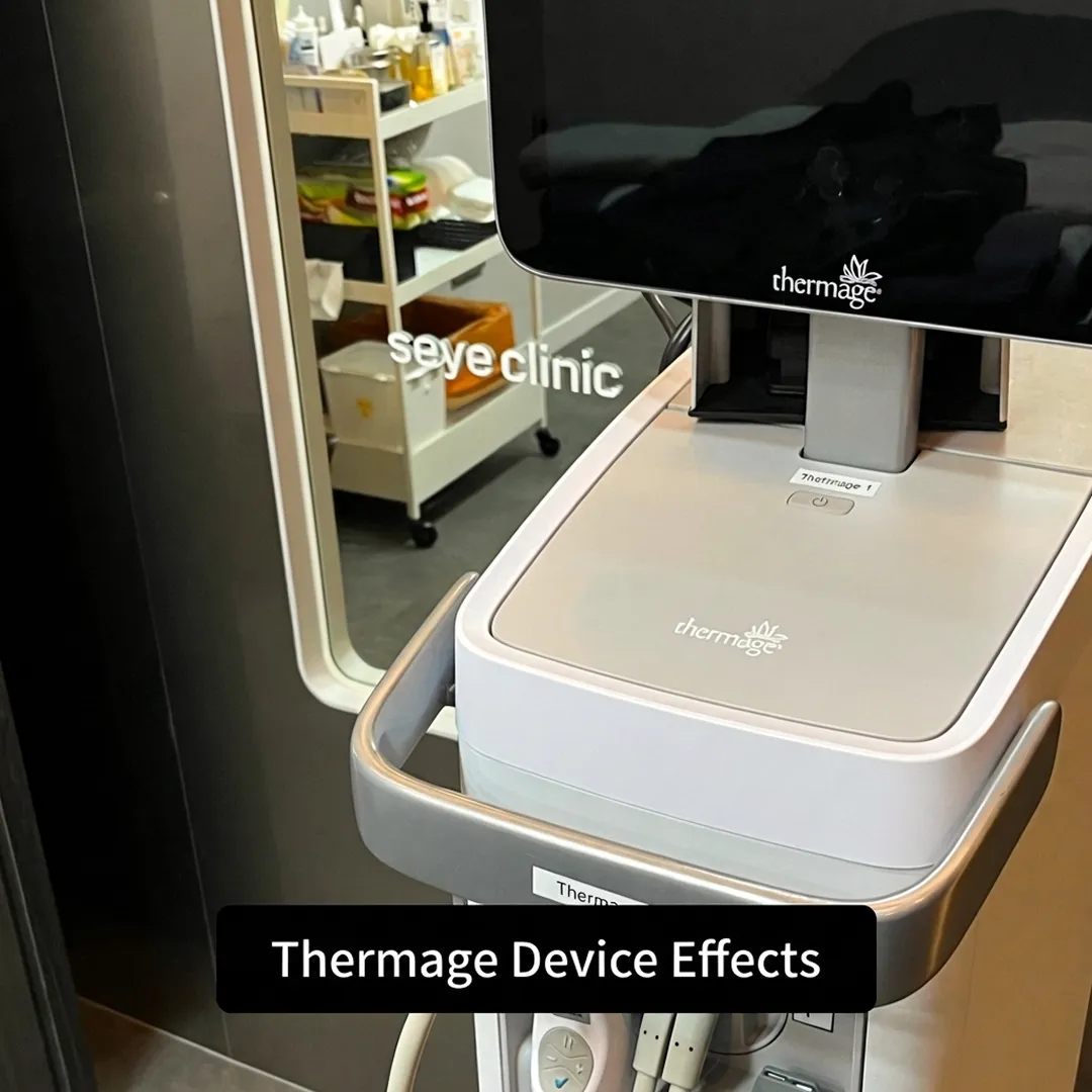 review-thermage-device-effects-seye-clinic-1-en.webp
