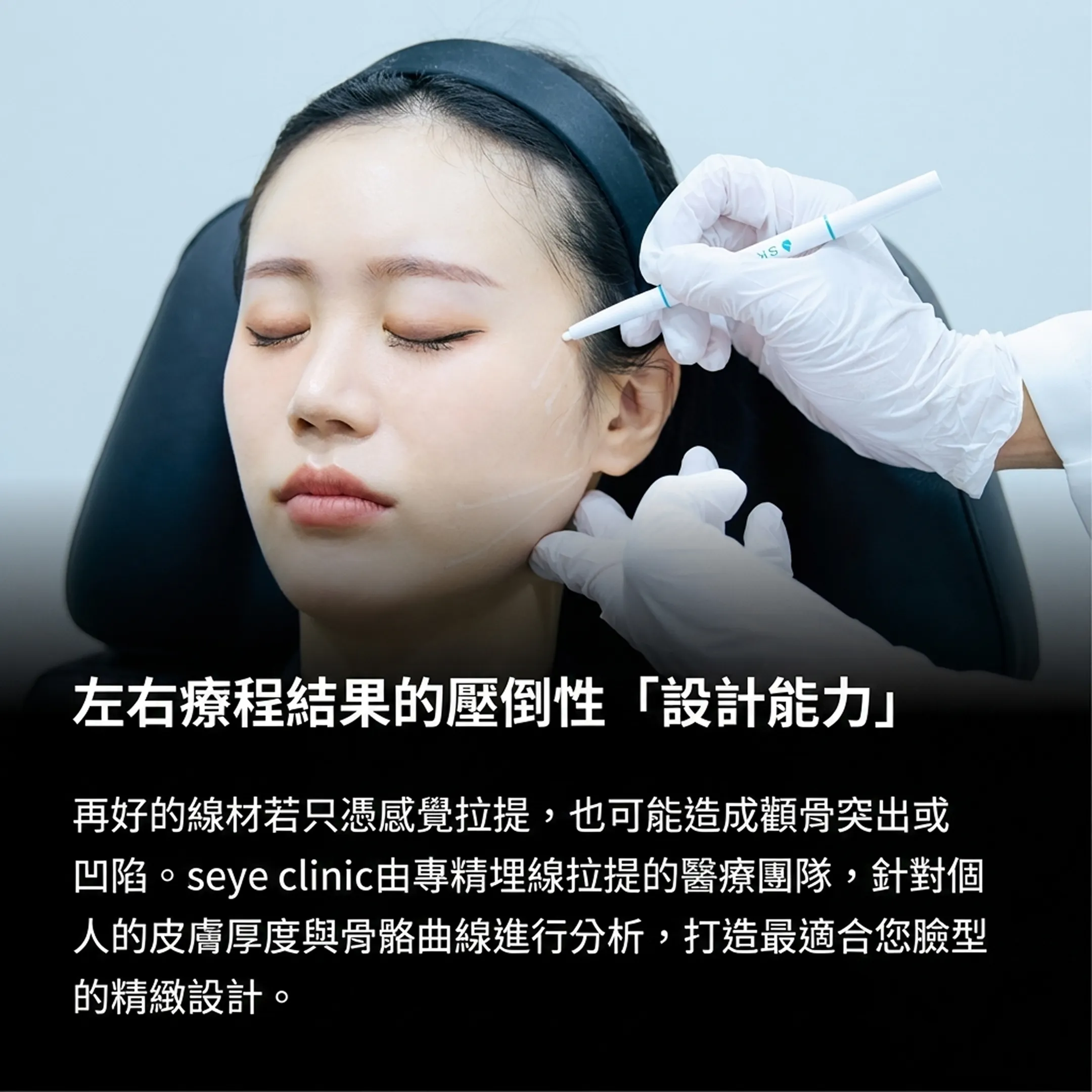 seye-clinic由專精埋線拉提的醫療團隊,針對個人-再好的線材若只憑感覺拉提,也可能造成顴骨突出或凹陷-的皮膚厚度與骨骼曲線進行分析,打造最適合您臉.webp