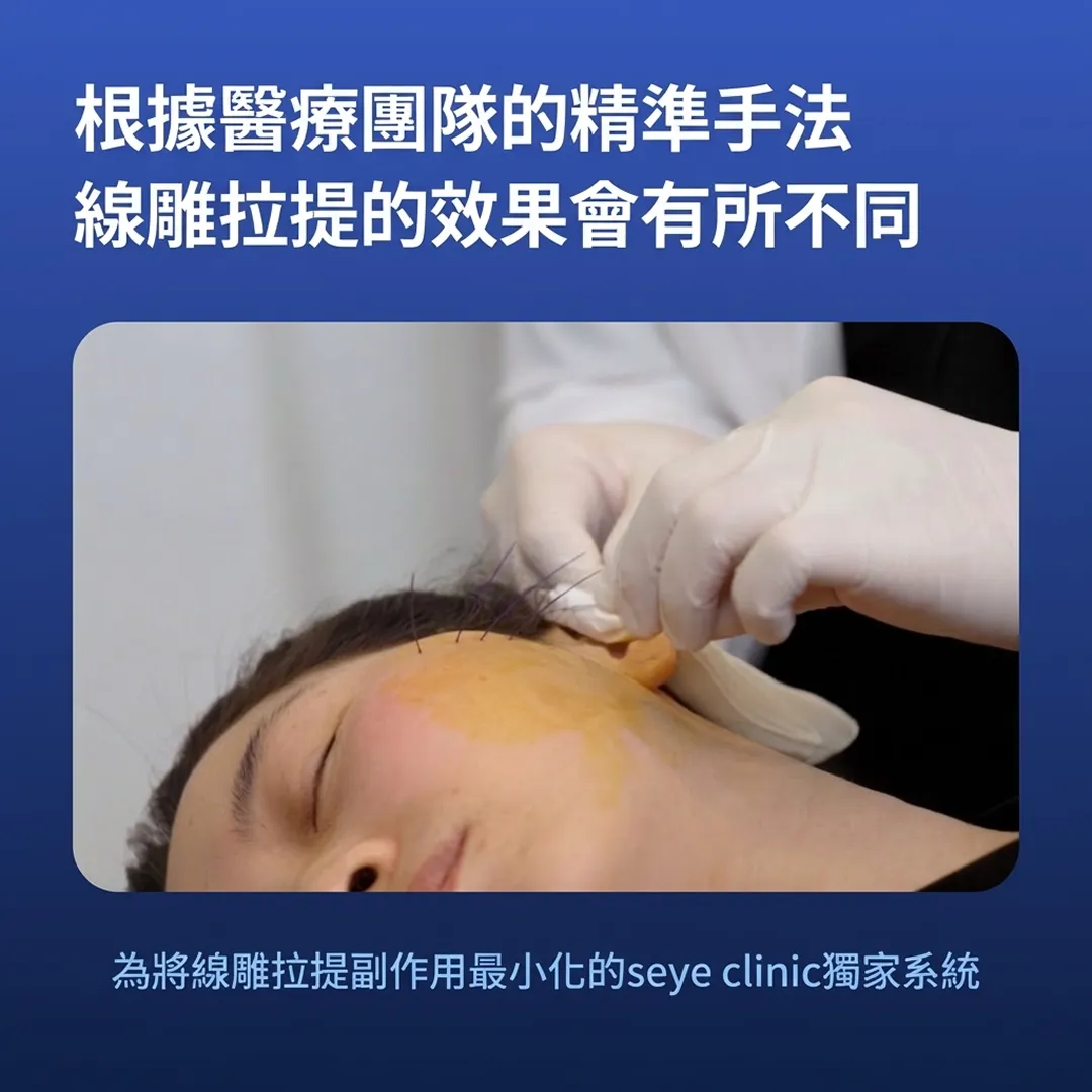 seye-clinic-為將線雕拉提副作用最小化的seye-clinic獨家系統-線雕拉提的效果會有所不同-根據醫療團隊的精準手法-zh-tw.webp