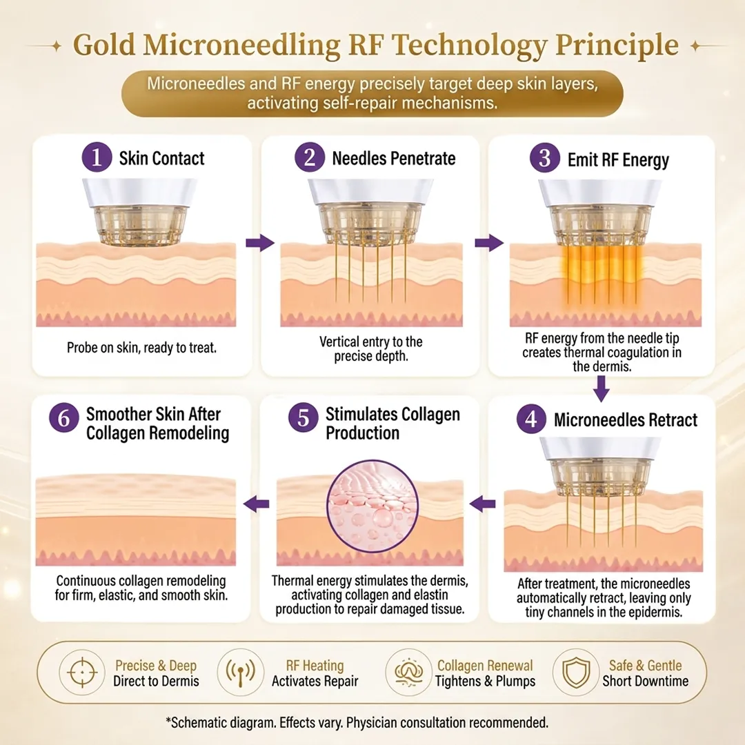 seye-clinic-gangnam-skin-consultation-microneedles-rf-energy-precisely-target-probe-ready-en.webp