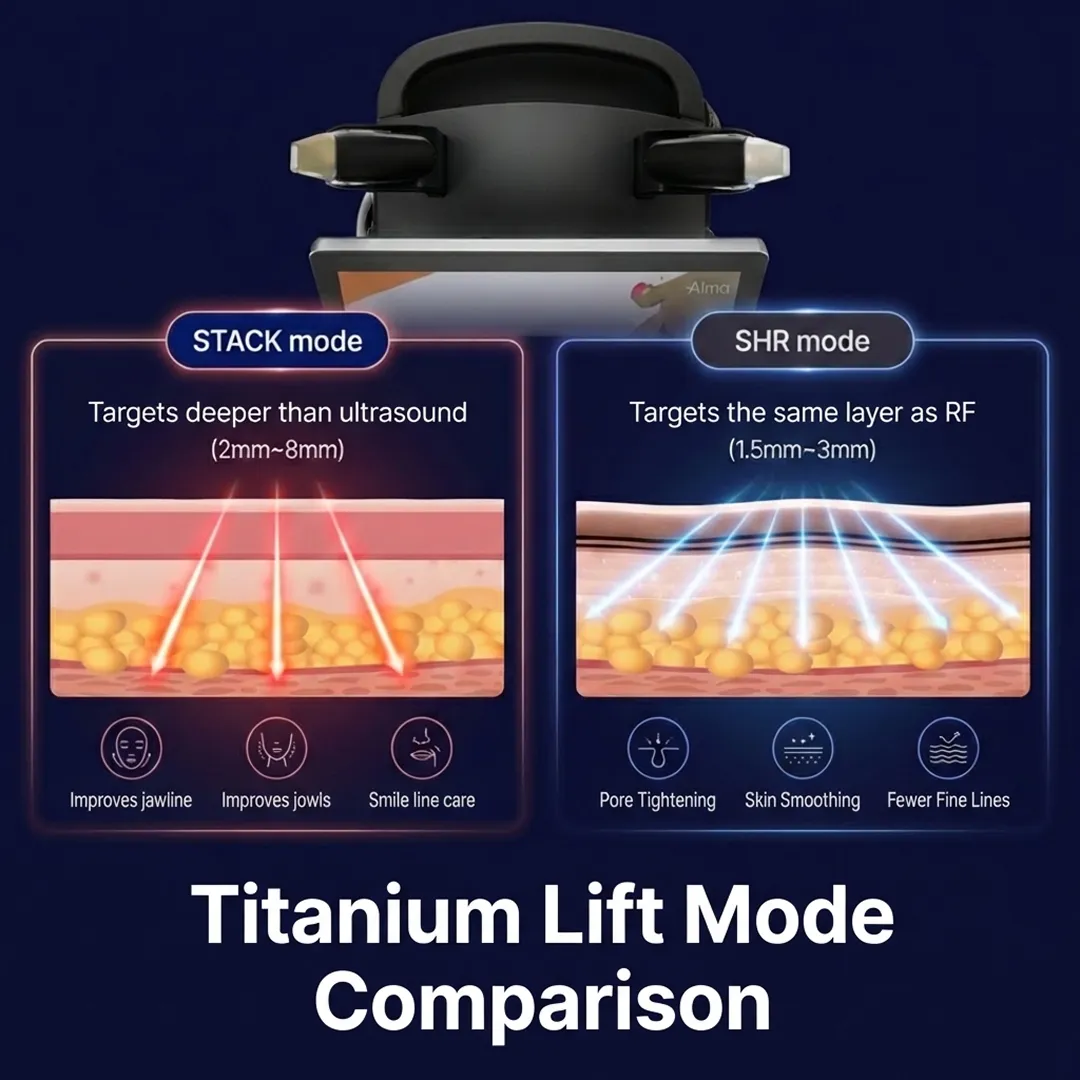 Titanium Lifting before and after results, demonstrating extended longevity through collagen regeneration at Seye Clinic.