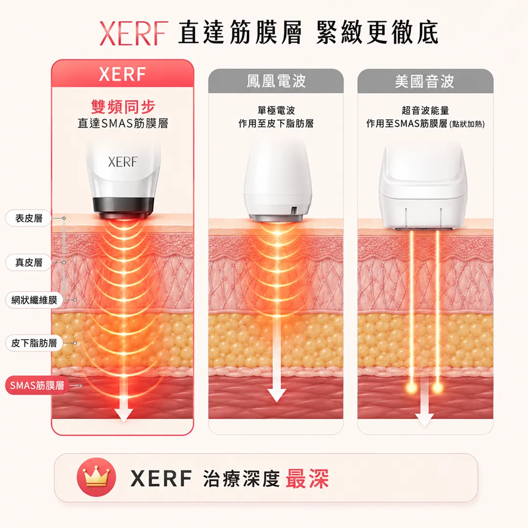 xerf電波-雙頻電波-緊緻肌膚-治療深度-比較其他施術-鳳凰電波-美國音波.webp