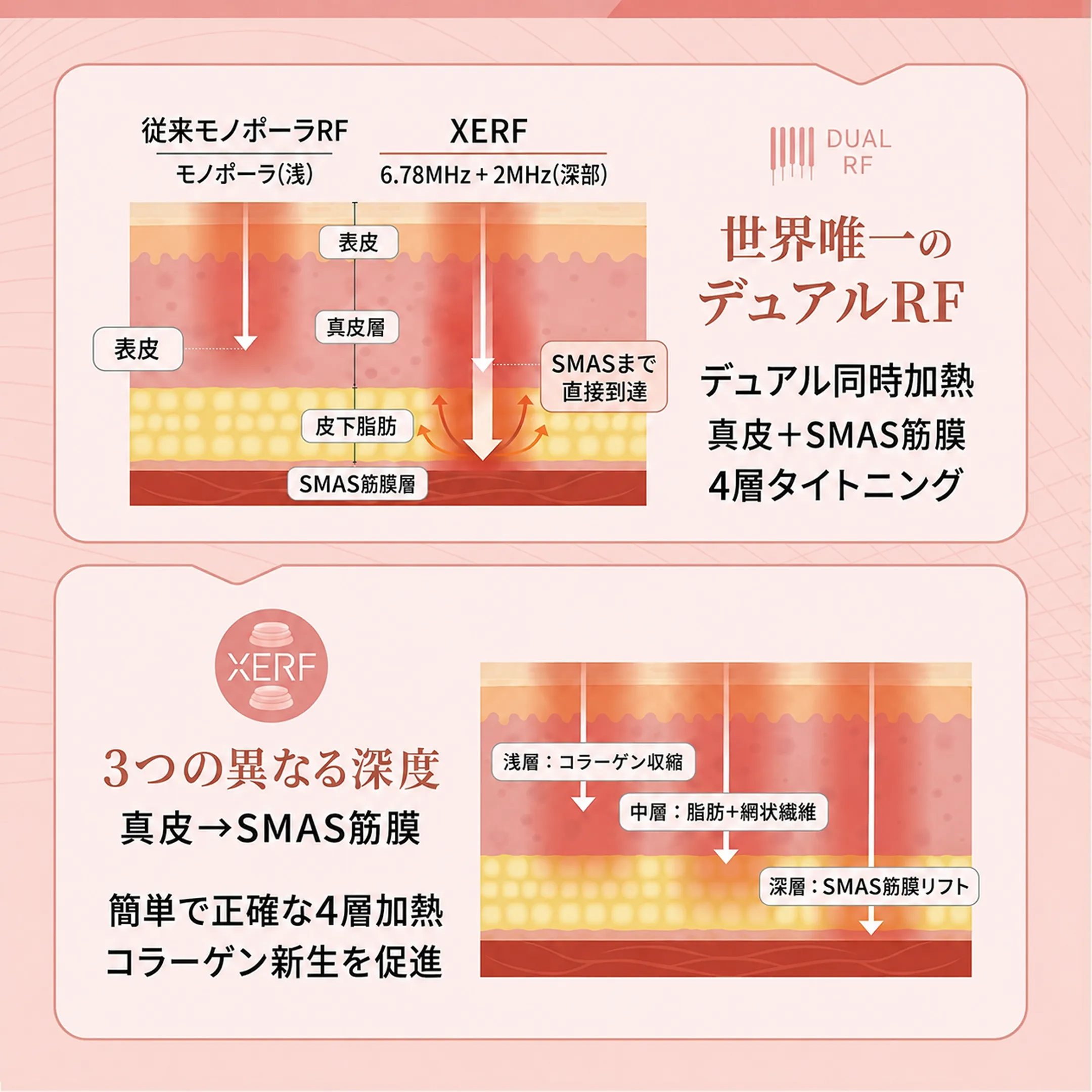 xerf-dual-rf-4層-tightening-shinpi-smas-depth.webp